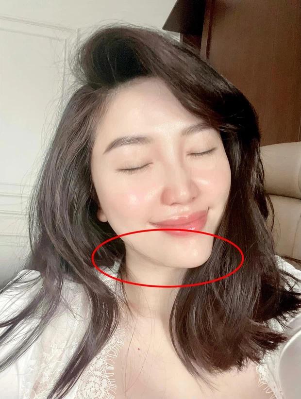 Bảo Thy xuất hiện với chiếc cằm lệch, nghi gọt mặt 80 lần-1