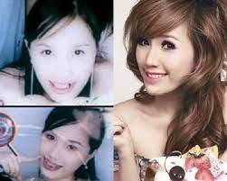 Bảo Thy xuất hiện với chiếc cằm lệch, nghi gọt mặt 80 lần-8