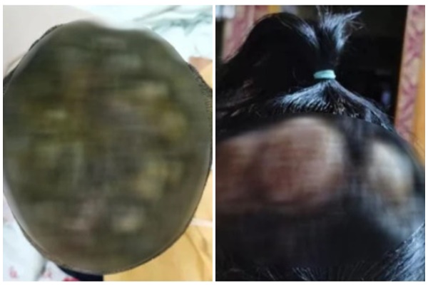 Mẹ đẻ của vaccine AstraZeneca nói về việc có nên tiêm mũi 3 tăng cường vaccine phòng COVID-19 hay không-3