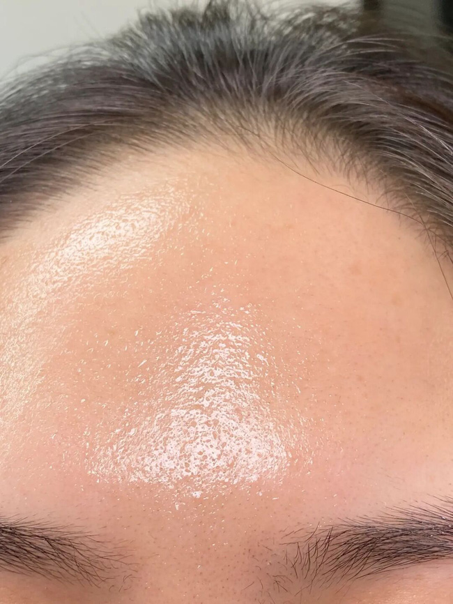 Làn da xuất hiện 5 dấu hiệu này thì chứng tỏ bạn đang bị kích ứng với mỹ phẩm đang dùng-2