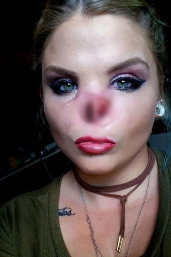 Bị chó pitbull hung dữ cắn đứt lìa mũi ra khỏi mặt, người phụ nữ chia sẻ hình ảnh diện mạo mới ở hiện tại sau 4 năm gây bất ngờ-5