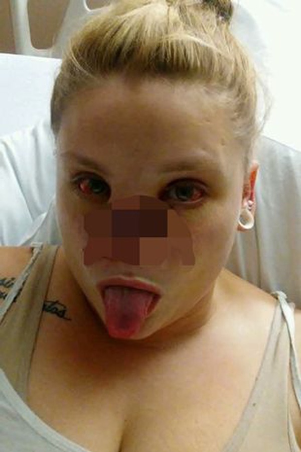 Bị chó pitbull hung dữ cắn đứt lìa mũi ra khỏi mặt, người phụ nữ chia sẻ hình ảnh diện mạo mới ở hiện tại sau 4 năm gây bất ngờ-3