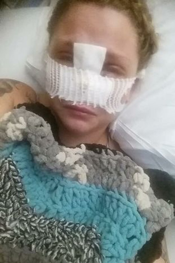 Bị chó pitbull hung dữ cắn đứt lìa mũi ra khỏi mặt, người phụ nữ chia sẻ hình ảnh diện mạo mới ở hiện tại sau 4 năm gây bất ngờ-2