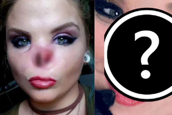 Pitbull nhảy qua hàng rào tấn công chó săn thỏ, gậy gộc cũng thành vô dụng-2