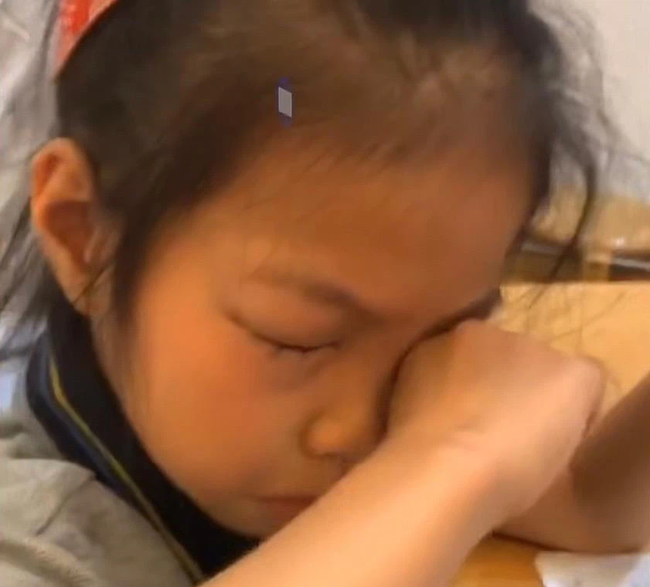 Bé gái 9 tuổi mắc chứng dị ứng lạ đời, hễ làm toán thì mắt lại sưng húp, dân mạng đưa ra suy đoán khiến phụ huynh hoang mang-1