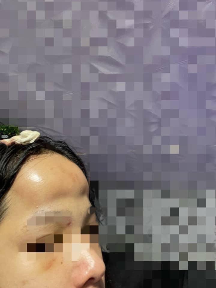 Vừa buồn cười vừa thương cô gái độn trán như ổi rơi trúng đầu-2