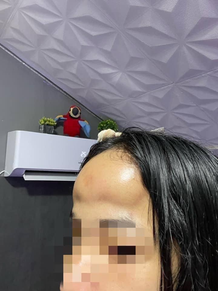 Vừa buồn cười vừa thương cô gái độn trán như ổi rơi trúng đầu-3