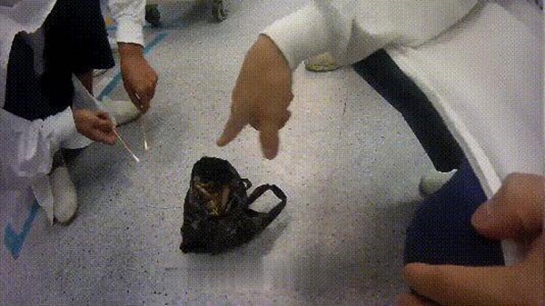 Rắn hổ mang bị dân làng đánh thừa sống thiếu chết, nhờ chiêu bài xảo quyệt đã khiến một người đàn ông rơi vào nguy kịch-3