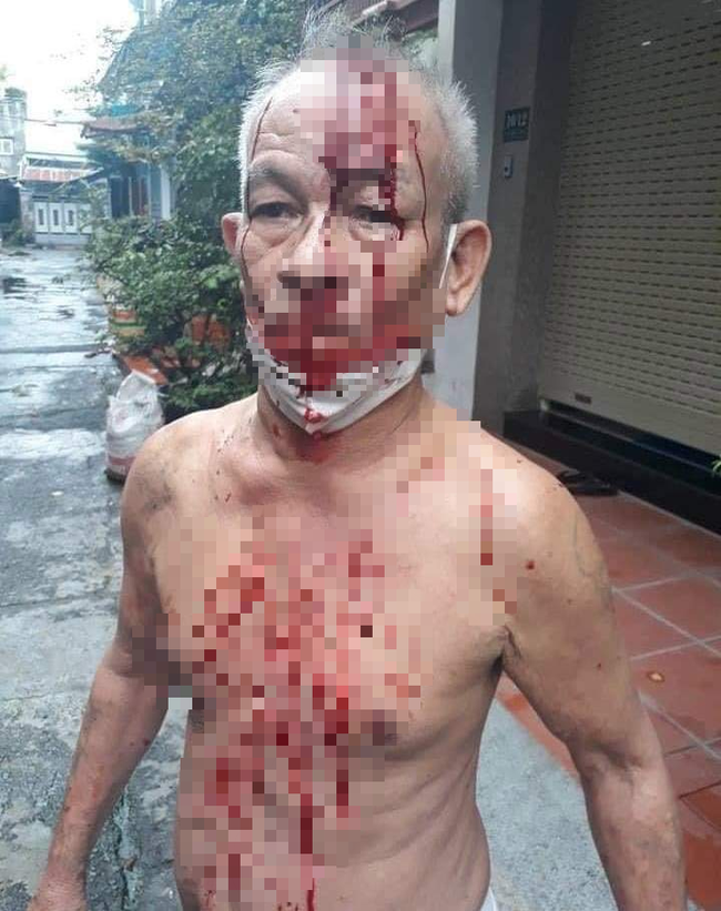 Thực hư clip người đàn ông đầu bê bết máu vì hỏi trợ cấp bị ném gạch vào đầu-1