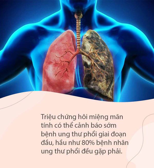 Miệng có mùi đặc biệt này không ung thư thì cũng suy thận, tiểu đường, can thiệp sớm sẽ phòng ngừa các biến chứng nguy hiểm-5