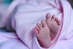 Bé sơ sinh mắc chứng ly thượng bì bọng nước bẩm sinh - bệnh di truyền hiếm gặp-2