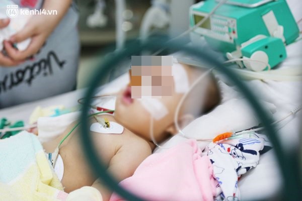Cân não giành sự sống cho hàng trăm em bé F0 nguy kịch ở bệnh viện tuyến cuối điều trị Covid-19-2