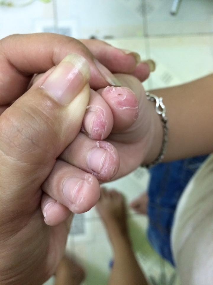 Trẻ nghiện cắn móng tay có thể bắt nguồn từ một căn bệnh tâm lý, cha mẹ cần loại bỏ càng sớm càng tốt-4