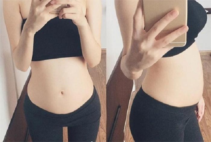 Cũng là mang thai, tại sao có người mang thai bụng to người lại bụng nhỏ? Bà bầu mà bụng nhỏ có ảnh hưởng đến sự phát triển của thai nhi không?-1