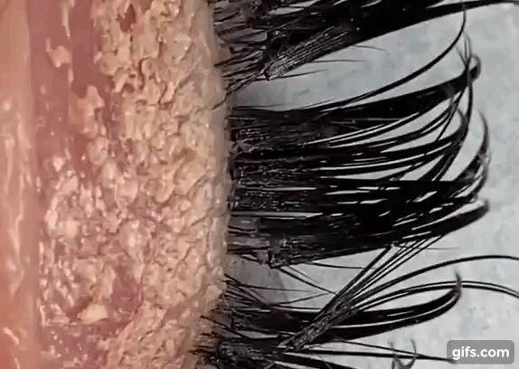 Nhân viên tiệm spa phát buồn nôn khi nhìn thấy cảnh tượng trên mi mắt khách, dân mạng xem xong cũng tá hỏa-2