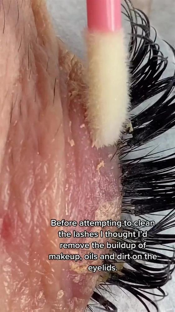 Nhân viên tiệm spa phát buồn nôn khi nhìn thấy cảnh tượng trên mi mắt khách, dân mạng xem xong cũng tá hỏa-1