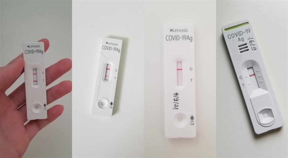 Di chứng sức khỏe của F0 hậu Covid-19-3