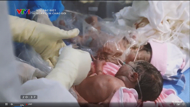 Phóng sự đặc biệt VTV Ngày con chào đời - giọt nước mắt hạnh phúc đón những sinh linh giữa đại dịch-2