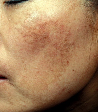 4 sai lầm nghiêm trọng khiến da bạn mãi xỉn màu, không thể sáng lên tông nào dù vất vả skincare-1