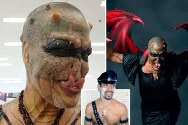 Gọi nhầm tên người khác khi thân mật với vợ, người đàn ông mất luôn của quý-2