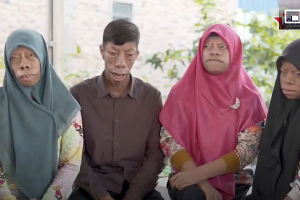 Tai nạn kinh hoàng: Thanh niên chạy xe tốc độ cao đâm ngang ô tô, văng xa hơn 30 mét đường-1