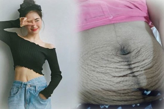 Các mẹ bầu đồng loạt khoe bụng đầy vết rạn thâm đen dưới bài đăng của Hòa Minzy: Những dấu tích của sự hi sinh, của tình yêu thương vô bờ bến