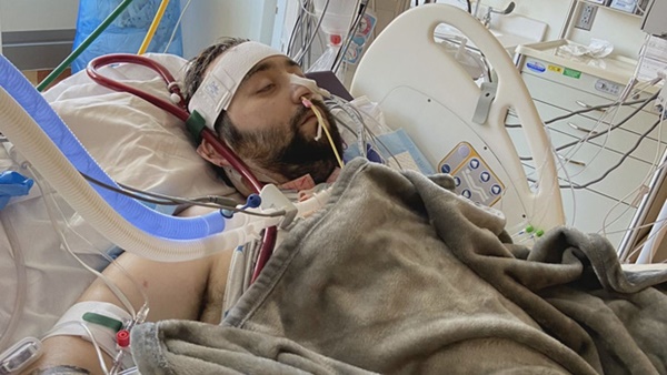 Người đàn ông bị Covid ăn sạch cả hai phổi và điều kỳ diệu đến từ cảnh tăm tối nhất-2