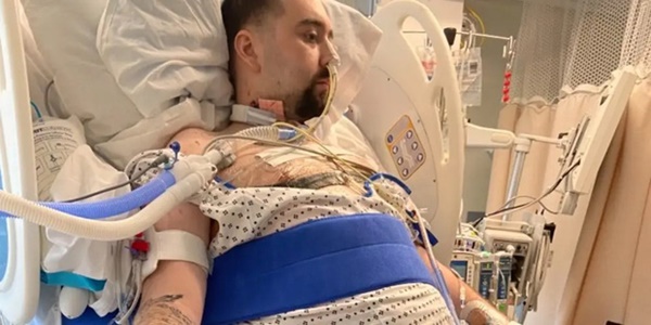 Người đàn ông bị Covid ăn sạch cả hai phổi và điều kỳ diệu đến từ cảnh tăm tối nhất-1
