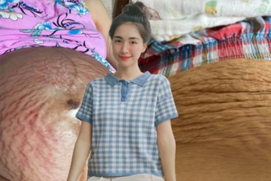 Từ việc Hòa Minzy khoe bụng rạn: Khoe ảnh chân thực có phải là hy sinh hay gây nên sự ám ảnh, sợ hãi?