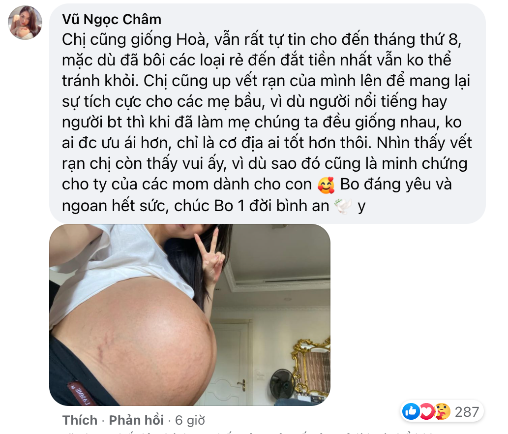 Từ việc Hòa Minzy khoe bụng rạn: Khoe ảnh chân thực có phải là hy sinh hay gây nên sự ám ảnh, sợ hãi?-6