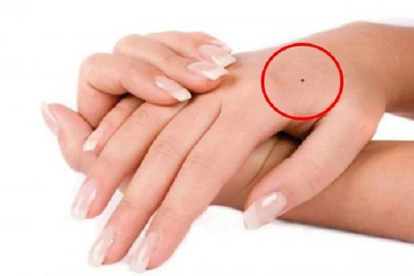 Bàn tay sở hữu 3 nốt ruồi vàng son này, cả cuộc đời chẳng bao giờ lo túng thiếu-1