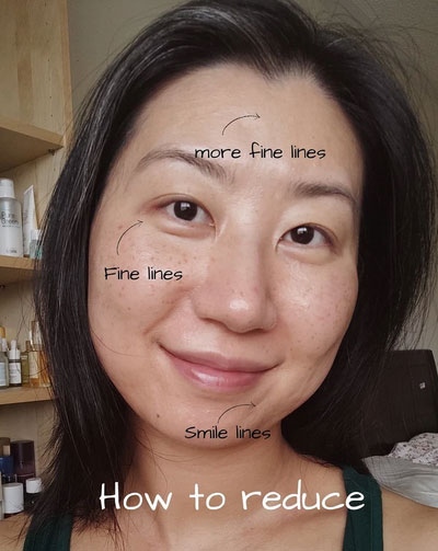 Bác sĩ gợi ý 3 bước skincare đơn giản để chặn đứng đốm nâu, tẩy sạch tỳ vết cho da đẹp mỹ mãn-1