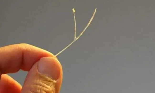 Con trai 4 tuổi hóc xương cá, bố kiên quyết không làm 3 việc để cứu mạng con, bác sĩ hết lời khen ngợi-2