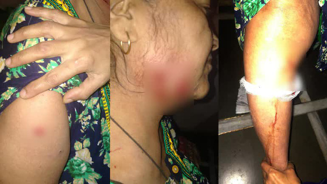 Đang ngồi hóng gió, người phụ nữ bị báo tấn công, thái độ siêu ngầu của bà dẫn đến kết cục đến người nhà cũng ngỡ ngàng-1