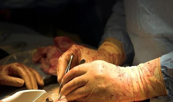 Điểm khác biệt lớn nhất giữa trẻ sinh mổ và trẻ sinh thường không phải là trí thông minh, hóa ra là ở khía cạnh này, bạn xem nhé!-2