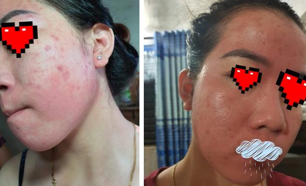 Shop mỹ phẩm nghi bán hàng fake khiến da khách toang hết hồn-11