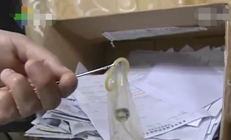 Cháu bé 5 tuổi vô tình nuốt phải viên bi thủy tinh, sau khi đưa đến bệnh viện, bác sĩ dùng vật dụng khó tin giải cứu thành công-3