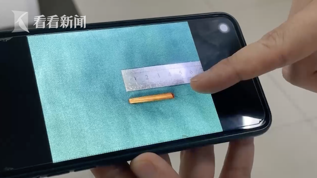 Bé gái 3 tuổi vừa ăn xong chạy ra ngoài thì bị ngã, nhìn thấy thứ con cầm trên tay, mẹ kinh hoàng vội đưa ngay đến bệnh viện-3