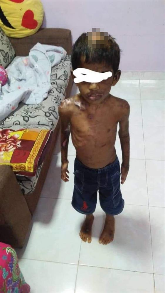 Tin tưởng gửi con cho bảo mẫu, 7 tháng sau người mẹ gặp lại đứa trẻ thân tàn ma dại, trông không khác gì nô lệ-1