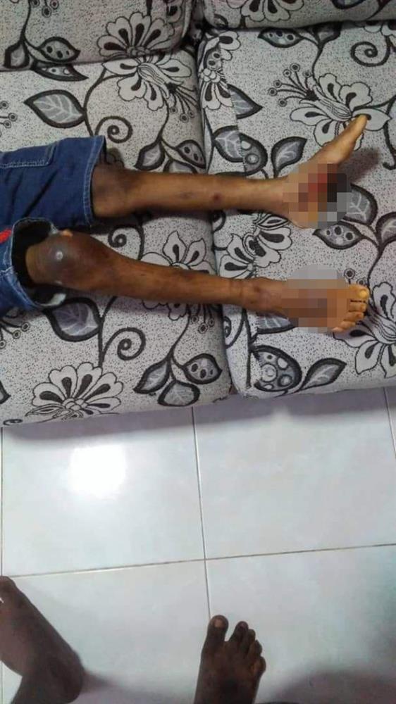 Tin tưởng gửi con cho bảo mẫu, 7 tháng sau người mẹ gặp lại đứa trẻ thân tàn ma dại, trông không khác gì nô lệ-4