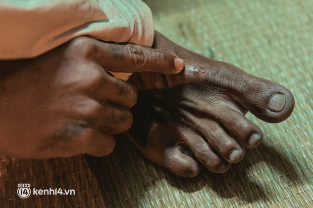 Đôi chân phồng rộp trên hành trình đi bộ hồi hương của những lao động nghèo, cả gia đình 4 người chỉ có 7.000 đồng dắt lưng-25