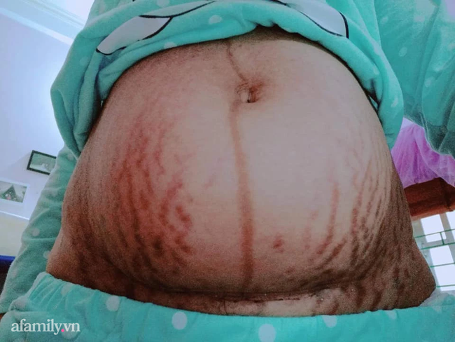 Mẹ bỉm hạnh phúc với hình xăm đẹp nhất đời phụ nữ, bụng nhão và rạn trắng vẫn không hề tự ti-1