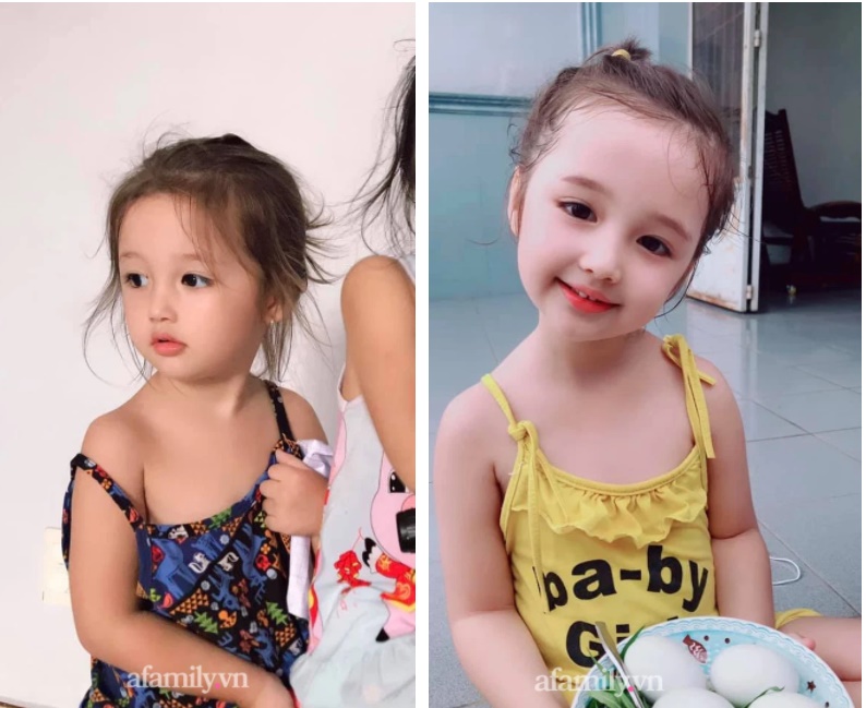 Bé gái vừa chào đời đã sở hữu chiếc mũi cao đáng ghen tỵ, 4 năm sau diện mạo gây choáng hơn-2