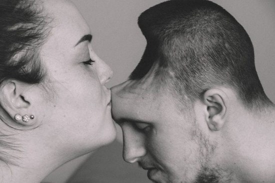 Ông bố trẻ đột ngột phải cắt bỏ nửa bộ não, lý do bắt nguồn từ một sai lầm đơn giản nhiều người mắc phải