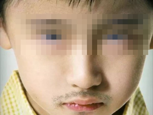 Bố mẹ hốt hoảng vì trẻ mầm non, tiểu học đã biết thủ dâm, nhưng hãy nghe lời khuyên của bác sĩ để biết cách can thiệp chính xác-3