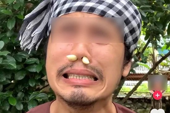 Trào lưu nhét tỏi vào mũi chữa viêm xoang rầm rộ trên Tiktok: Chuyên gia phản bác thế nào?