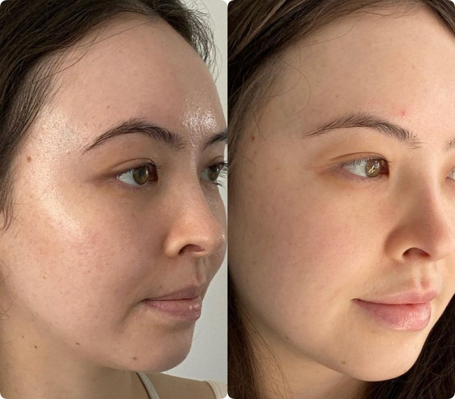 Vitamin C cho da nhạy cảm: Nhớ 5 điều này thì làn da thâm nám sẽ hồi xuân-1