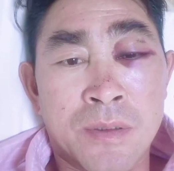 6 giây sinh tử khi người đàn ông lao đến cứu bé trai rơi từ tầng 4, đứa trẻ may mắn thoát nạn nhưng người hùng lãnh kết cục tả tơi-5