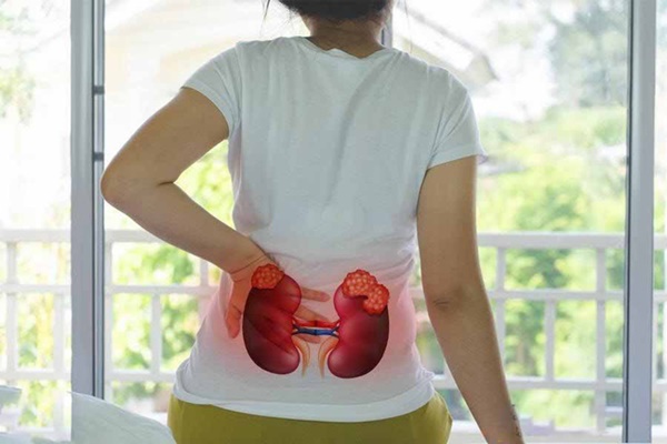 7 thói quen bị các chuyên gia liệt vào nhóm sát thủ hại thận, điều cuối cùng ai cũng mắc phải-1