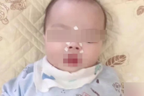 Cho rằng không cần uống thuốc, ho, sổ mũi vẫn bị đánh bay sau 5 phút nhờ đắp thứ này, chuyên gia cảnh báo một câu ai cũng giật mình-2